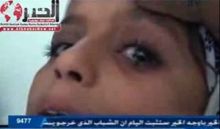 طفلة يمنية تدمع أحجارا ملونة بدلا عن الدموع !